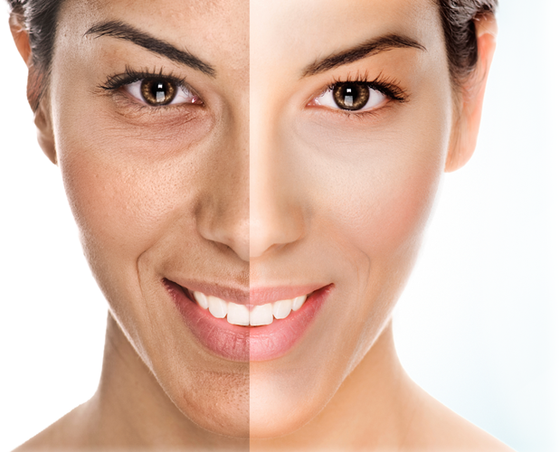 W8MD oxygen facial treatment